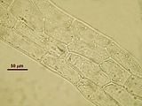 5 – Cellule delle lacinie apicali in visione superficiale